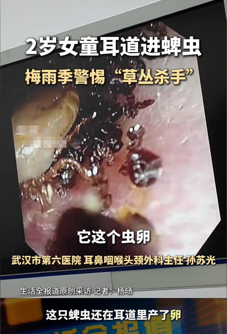 两岁女童耳朵疼,医生检查吓一跳:耳道里一只蜱虫和一堆虫卵