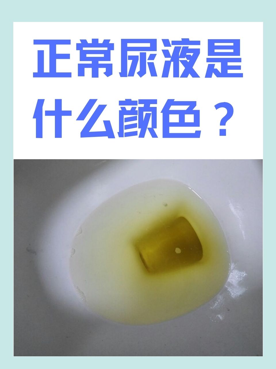 尿液正常颜色多是淡黄色,透明的