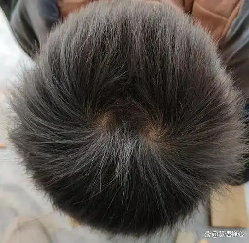 育儿相学揭秘:孩子头顶双旋的古老智慧,九成父母不知道的先天禀赋密码