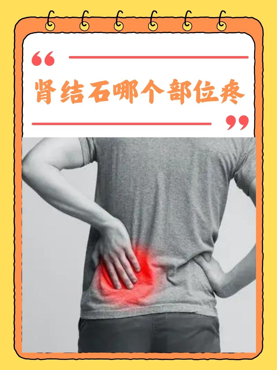 肾结石疼痛位置主要在腰部和腹部
