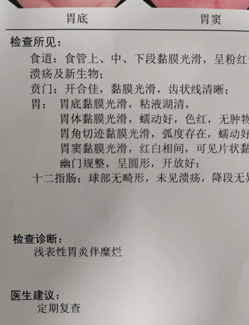 胃镜报告上的专业术语?