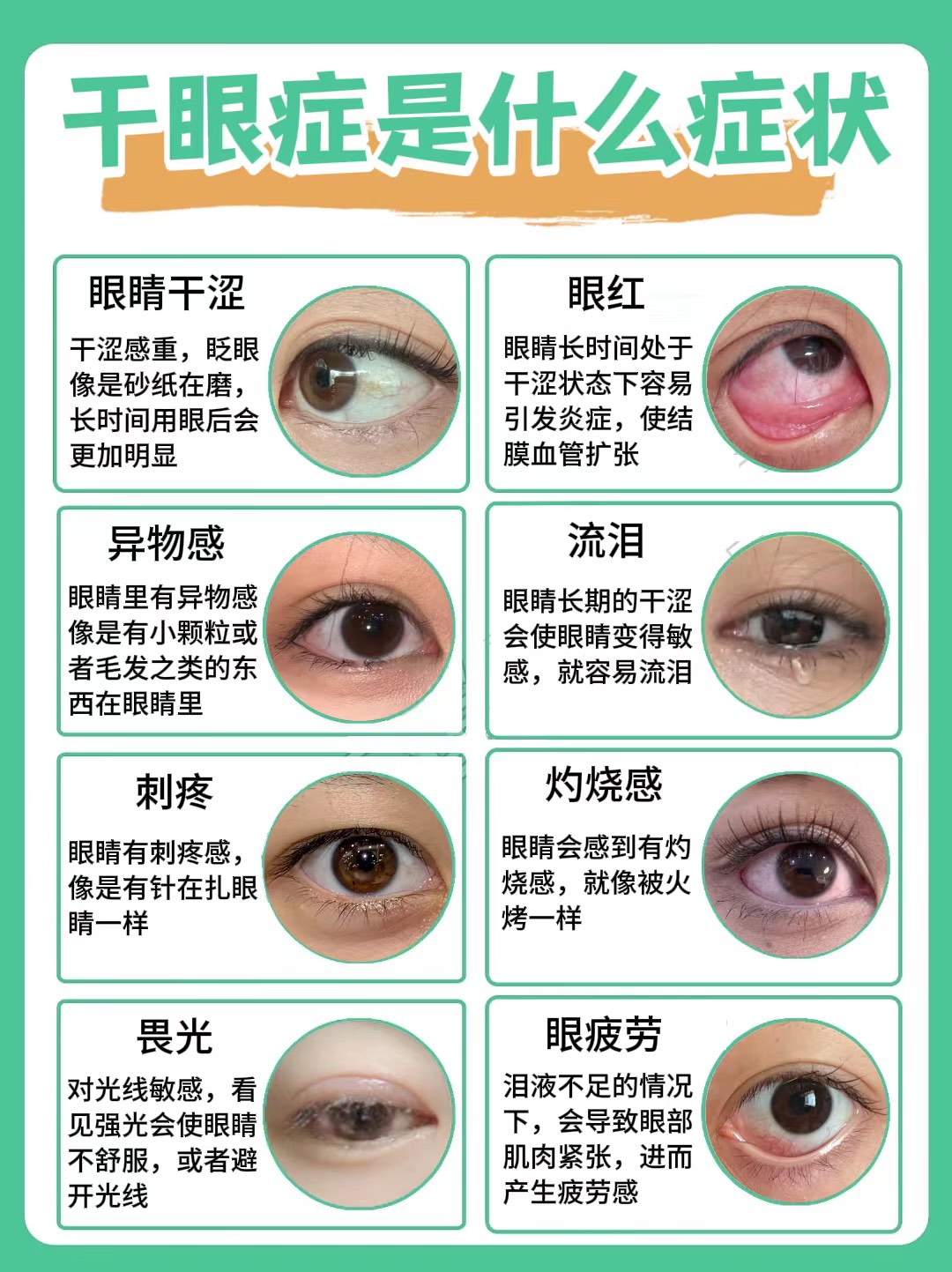 想知道自己是不是有干眼症,可从症状判断