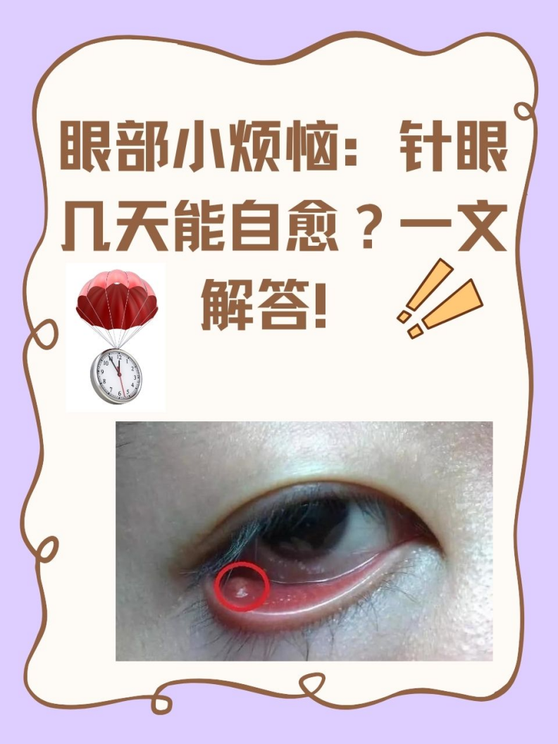 眼睛起针眼想快点好,可先热敷,再用消炎眼药水,严重时就医