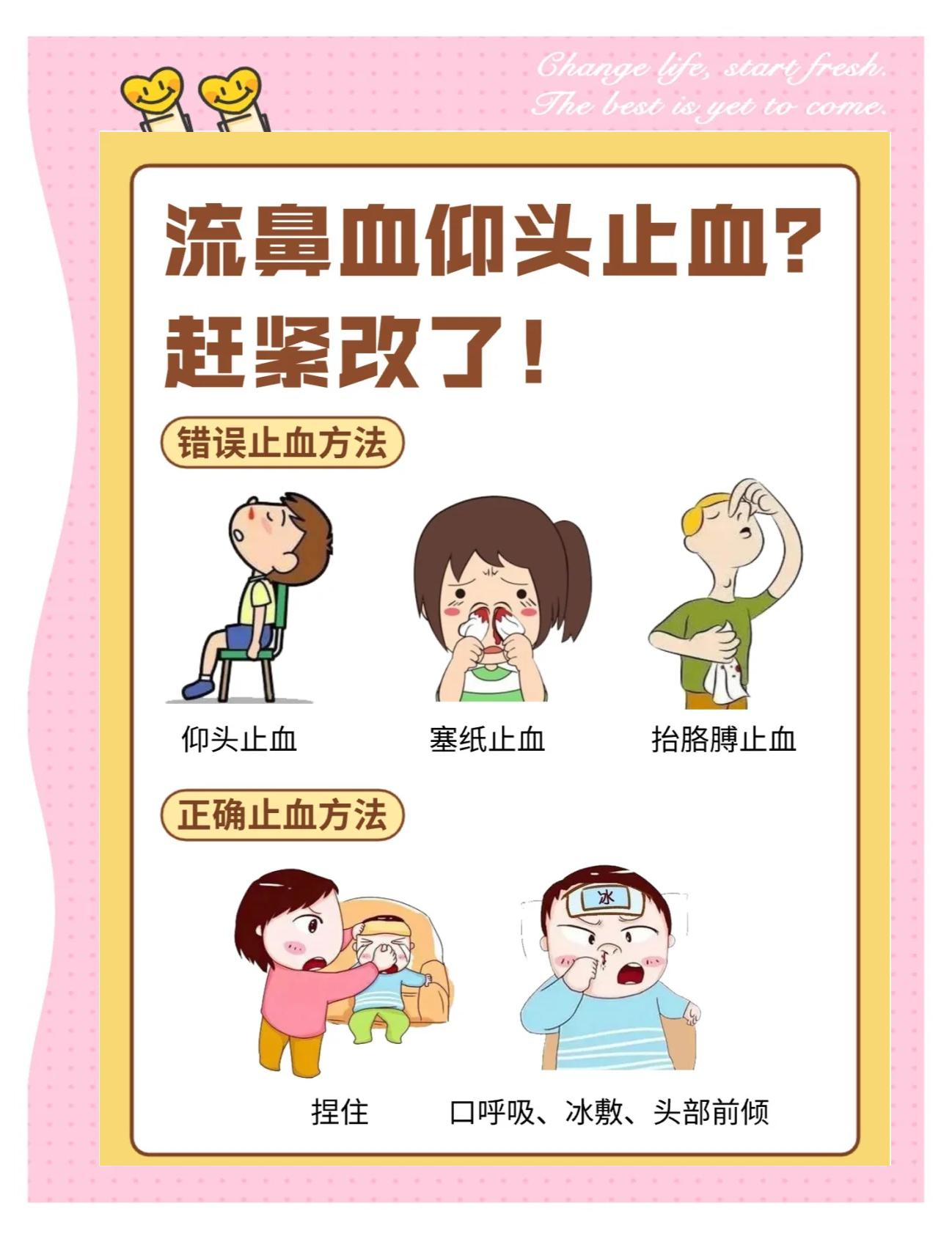 流鼻血时,别仰头,要身体前倾,手指捏鼻翼5