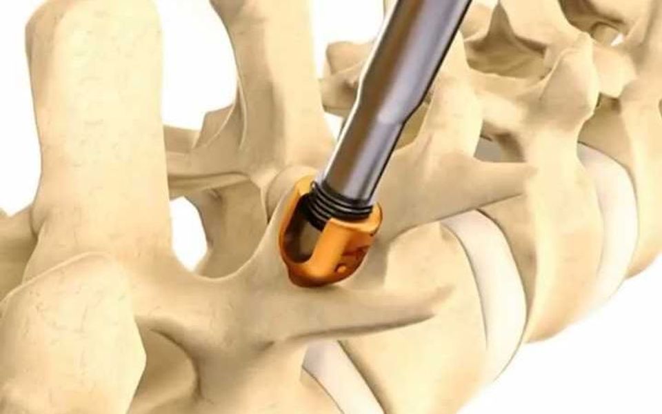 中国医生救回"身首离断"患者,医生称:手术难度堪比登天!