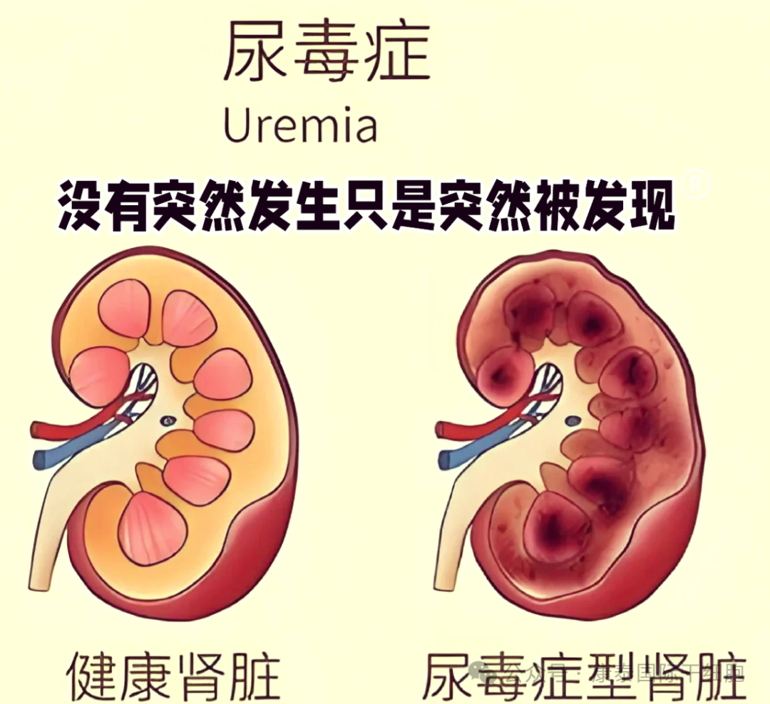 尿毒症为什么要透析