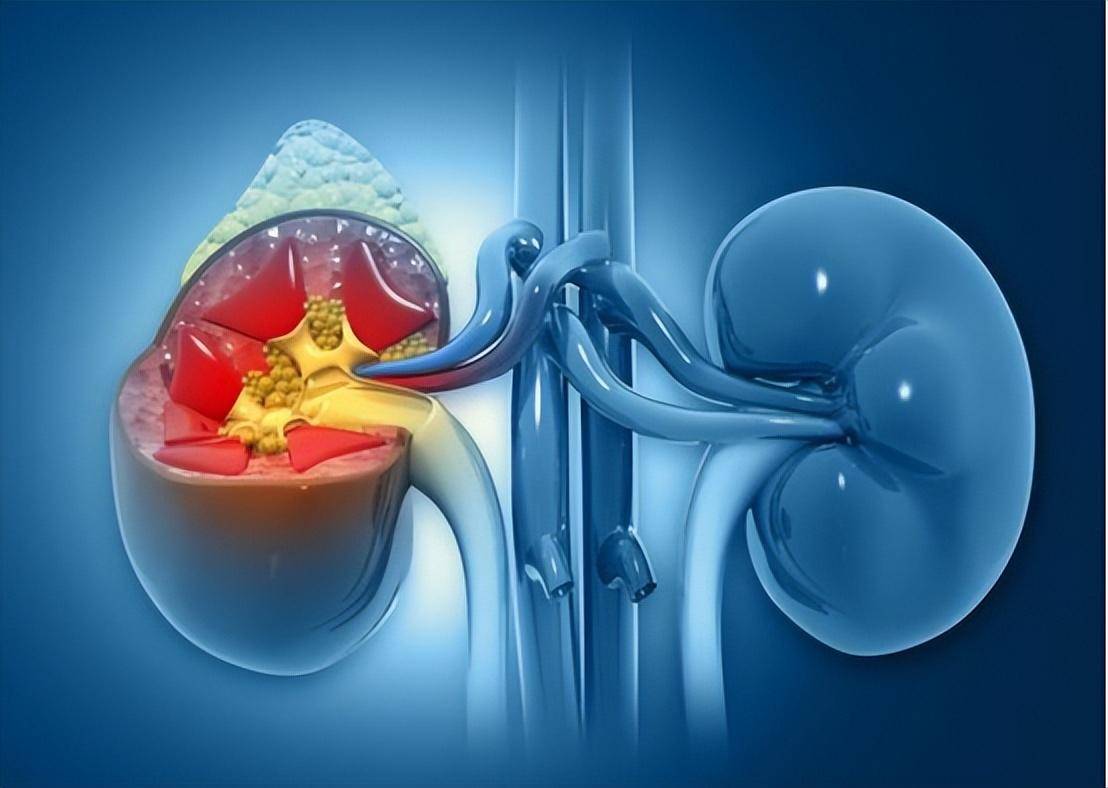 肾病这事儿,总是悄无声息地潜伏着,等你发现尿蛋白飙了,肌酐升了,可能