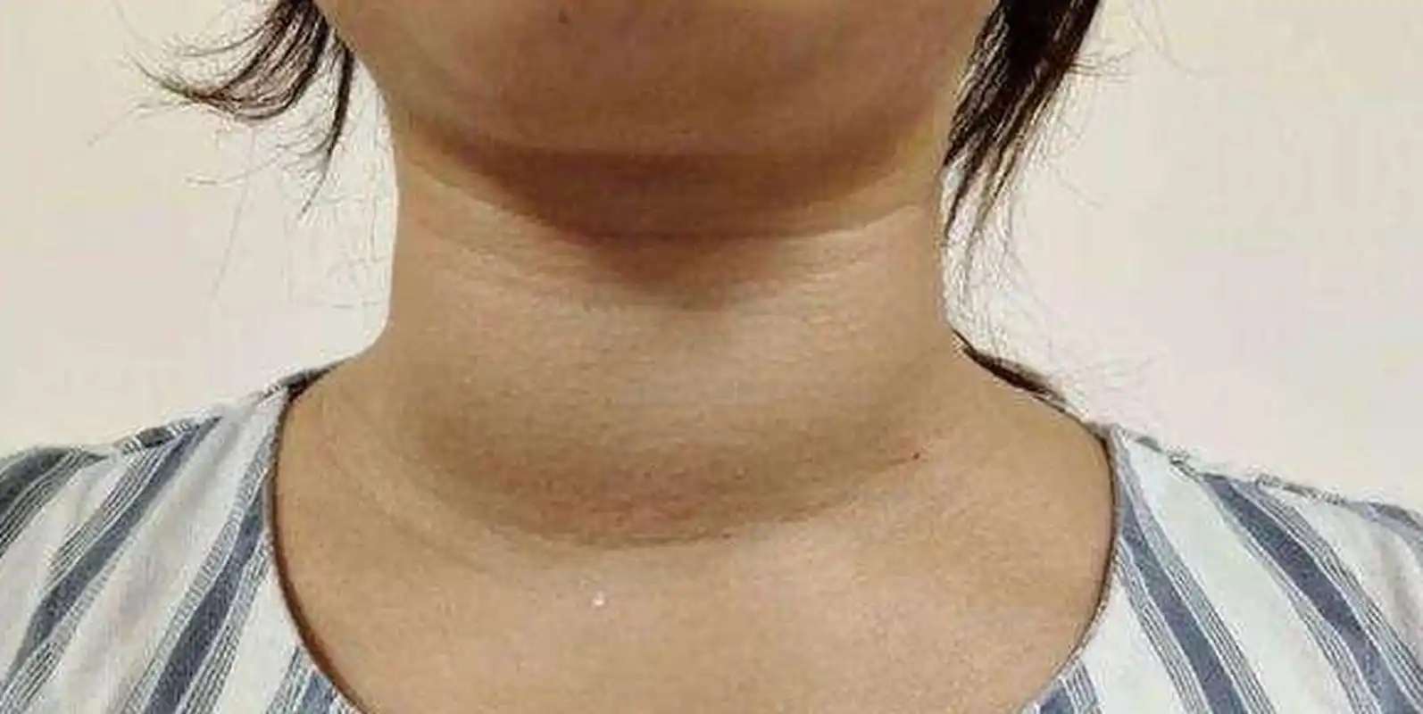 脖子的粗细,与寿命相关?脖子越粗的人,暗示寿命越短,是真的吗?