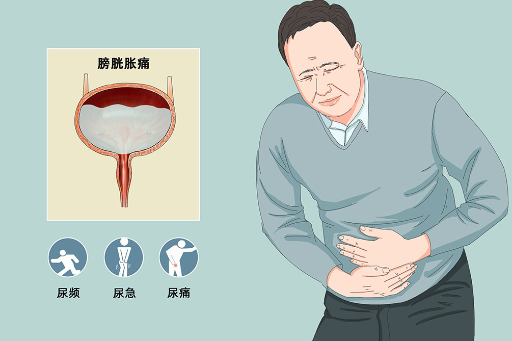 膀胱炎怎么破?消炎药又该如何使用?医生一文讲清