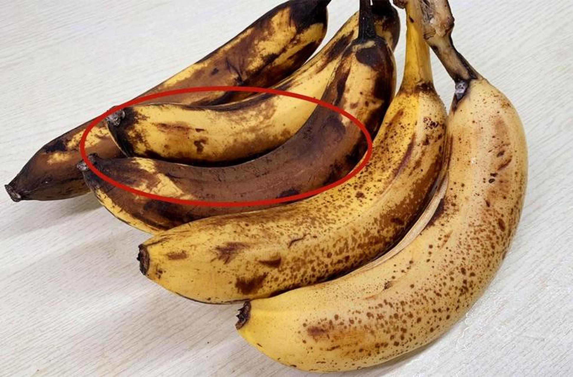 200根香蕉辐射量,等于拍一次胸片!医生:3种香蕉尽量别吃
