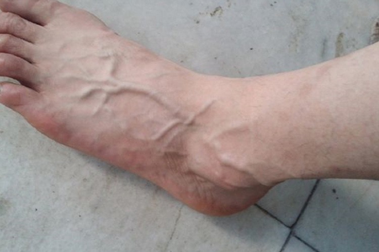 医生忠告:腿部出现这几种表现,尽快就医!别不当回事!