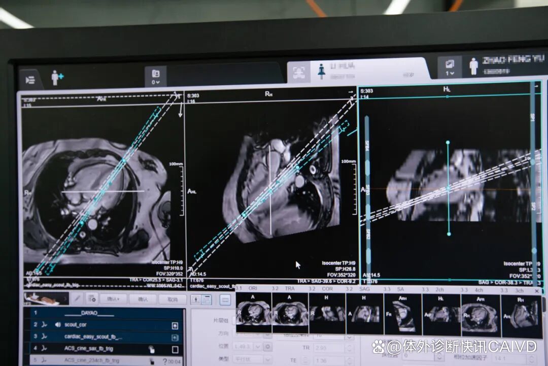 友谊医院挂专家号核磁加急-友谊医院挂专家号核磁加急多少钱 友谊医院挂专家号核磁加急-友谊医院挂专家号核磁加急多少钱
