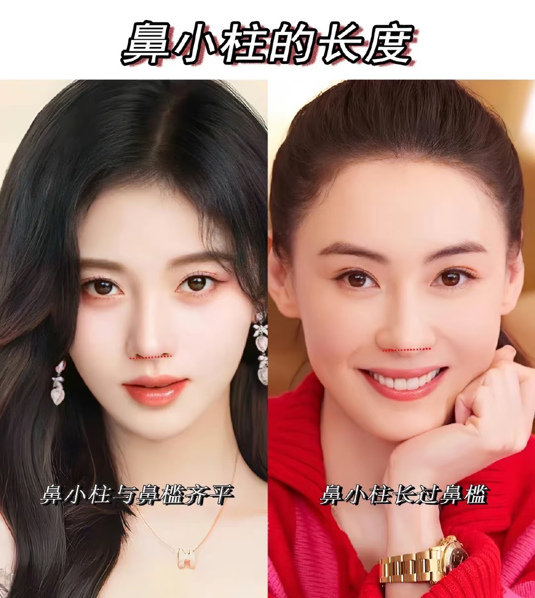比鼻子塌更可怕的是鼻孔外露显老又显凶很多明星遭殃
