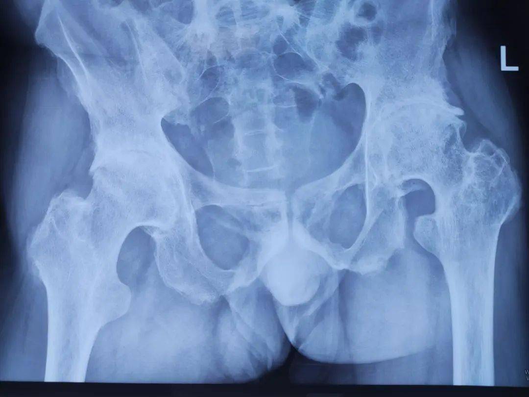 饭后散步不如在家坐着?医生告诫:年过60,饭后这3点不能忽视