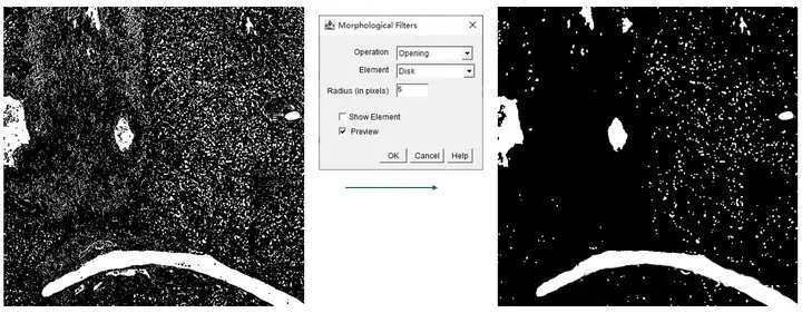 ImageJ实用教程——HE染色炎症浸润面积统计(案例分析篇)