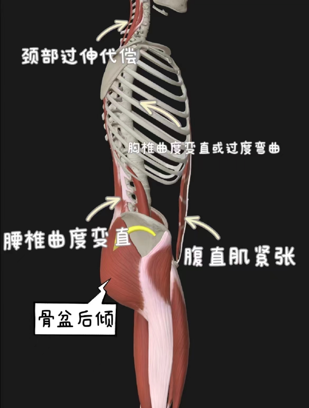 骶髂关节位置真人图片