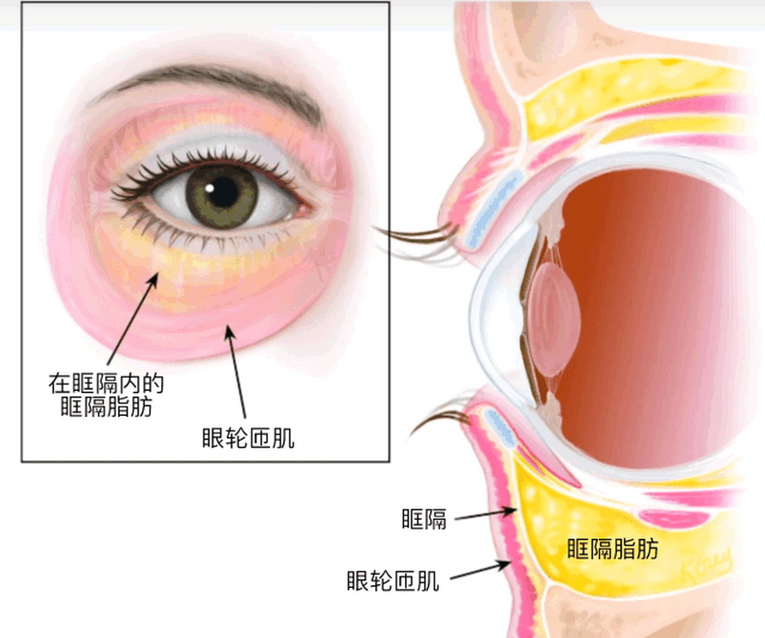 几乎天天都说眶隔脂肪释放术,今天讲讲到底什么是"眶隔?