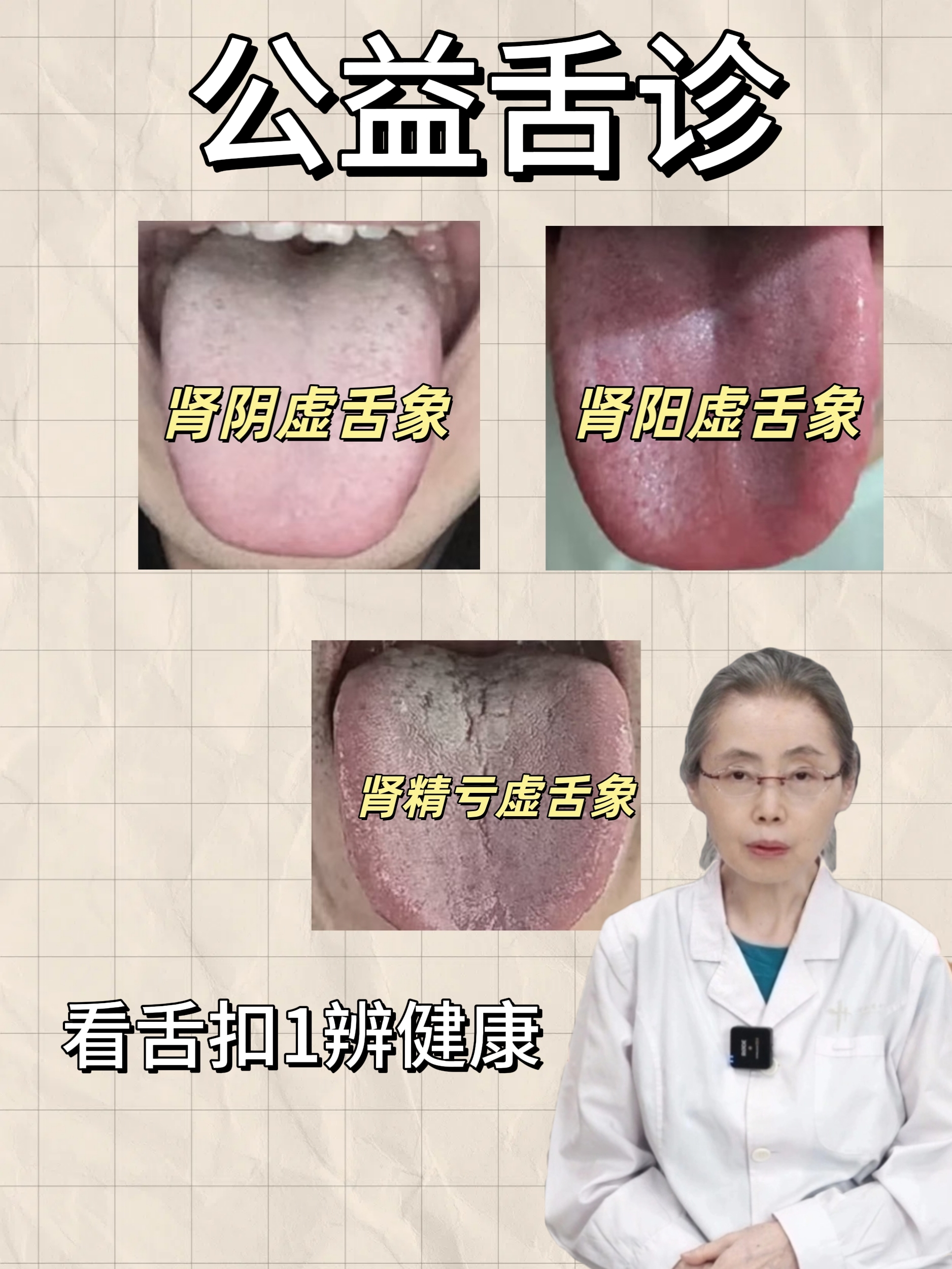 肾阴虚舌头发红舌苔少甚至没有这是肾阴虚的典型舌象