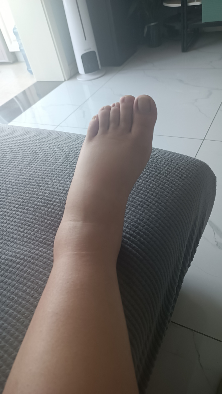 孕38周一觉睡起来脚丫子肿成了蔡文姬,这是怎么回事