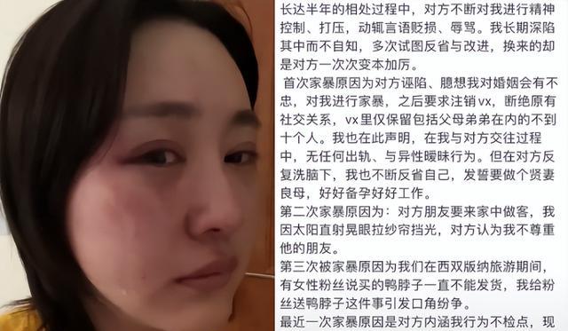 女网红遭丈夫家暴,晒出受伤照片及诊断证明:一直拖着不离婚