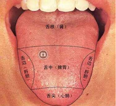 地图舌老是反反复复好不了,到底是怎么回事?