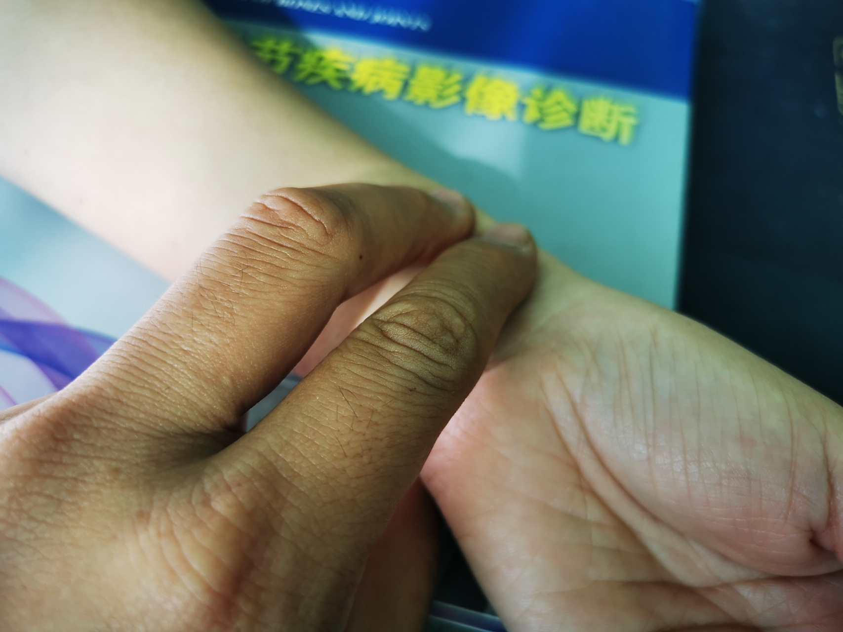 何大姐肩痛两个多月了,最近发现左侧上肢肌肉萎缩了,想到医院来看一看