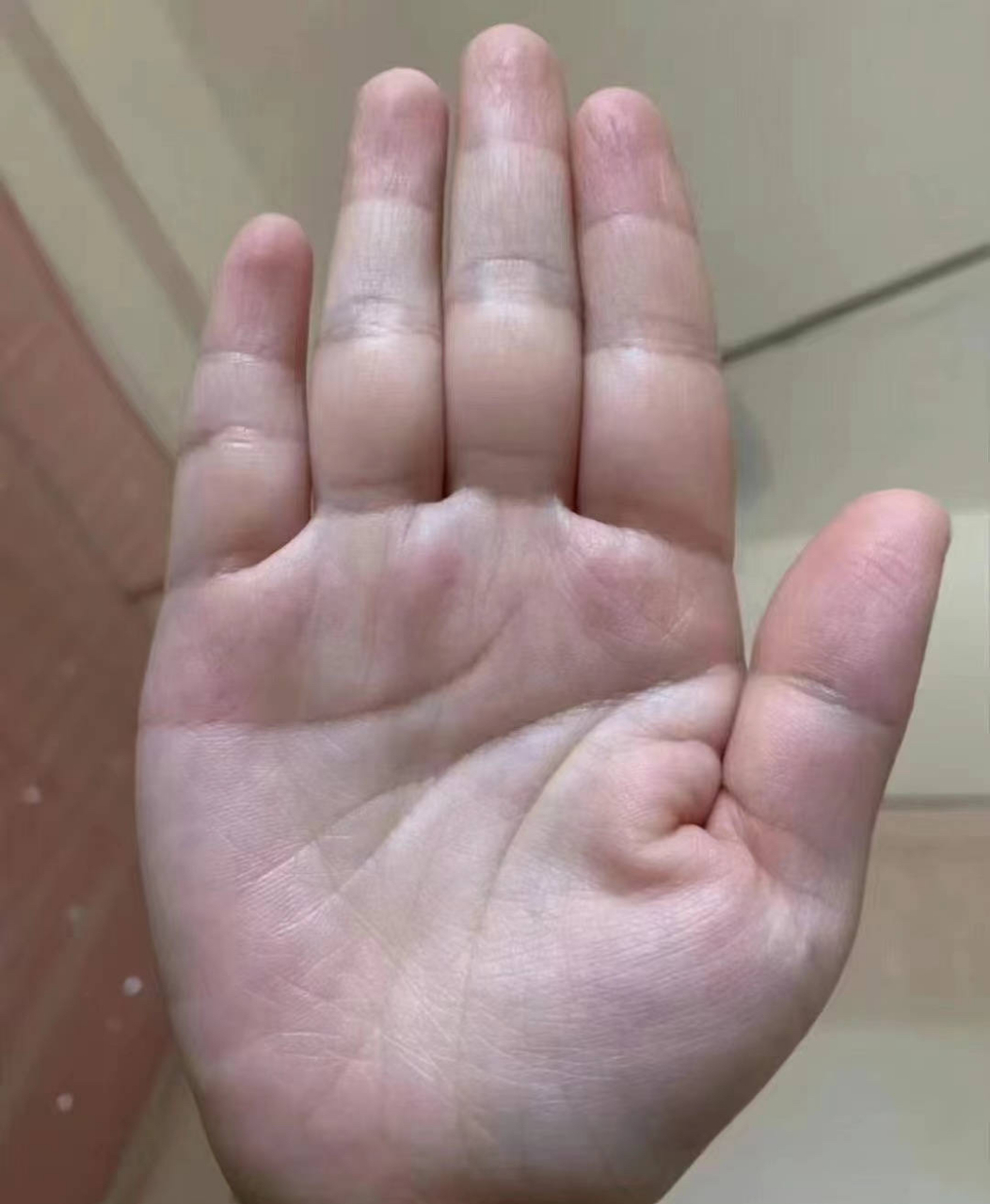 手纹分析案例:  感情线向上弯曲,无明显分叉和干扰,感情来得早,有早婚