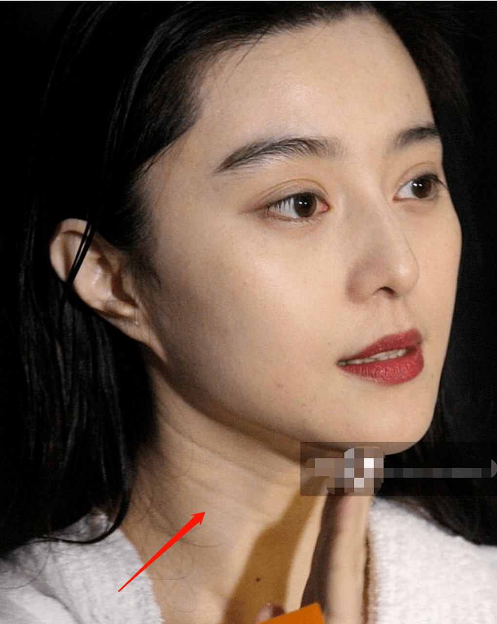 颈纹出现的原因有哪些?  1,先天颈部皮肤松弛和脂肪堆积,形成了颈纹.