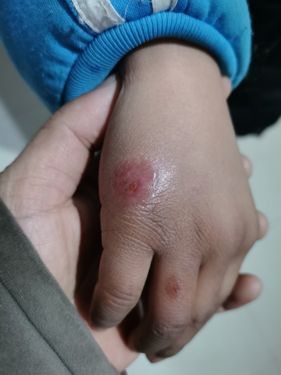 学校里孩子冻手的有好几个呢!小小年纪,看着这样的懂事,我