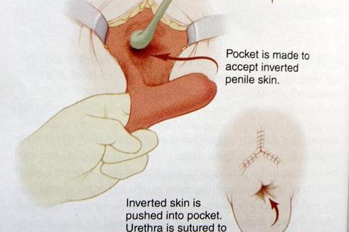 变性男""如何性侵"女狱友的