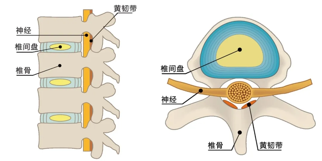 腰腿疼痛