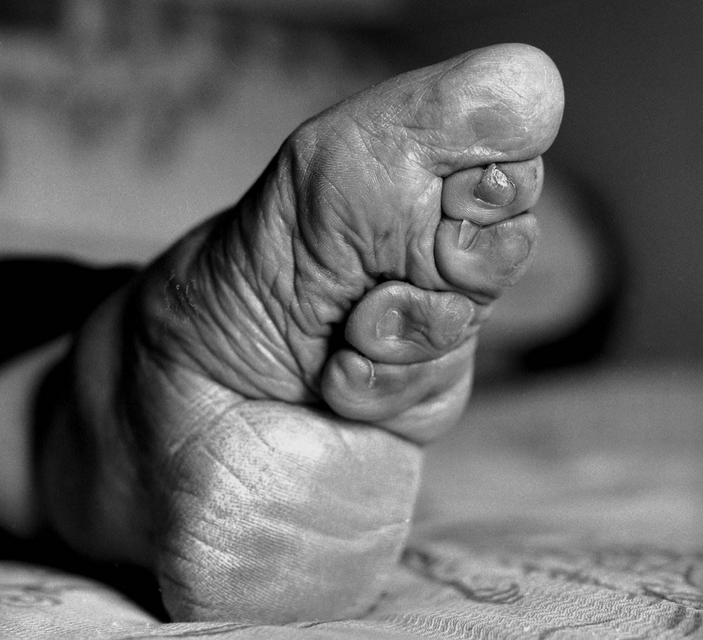 那时候女子缠足还没有达到明清时期"三寸金莲"的程