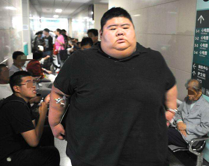 中国第一胖王浩楠,在女友陪伴下一年减掉400斤,同学见面认不出