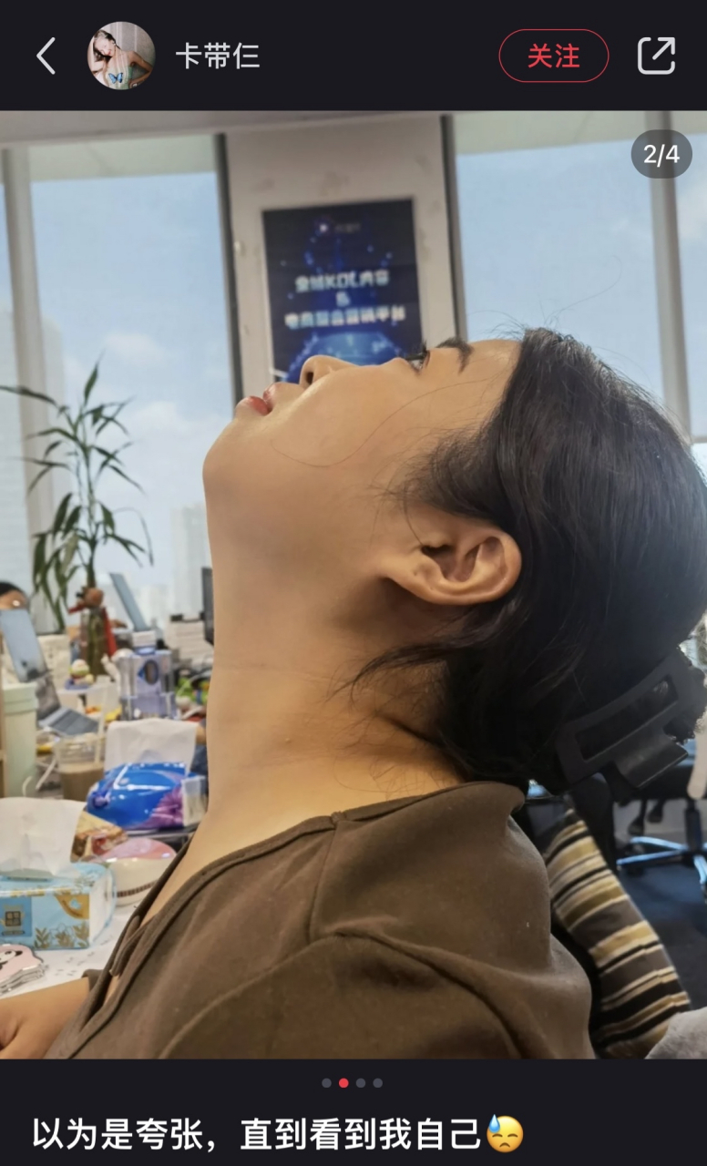 没有下巴是一种什么体验[大笑][大笑][大笑]