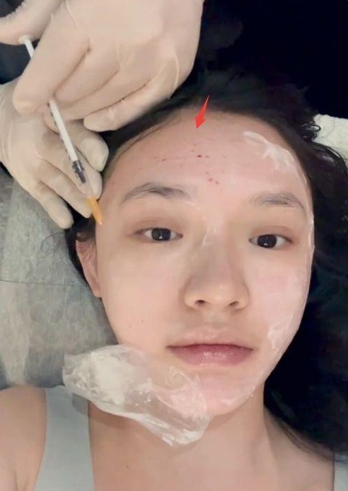 90%女明星都在打的水光针,真的有那么神奇吗?