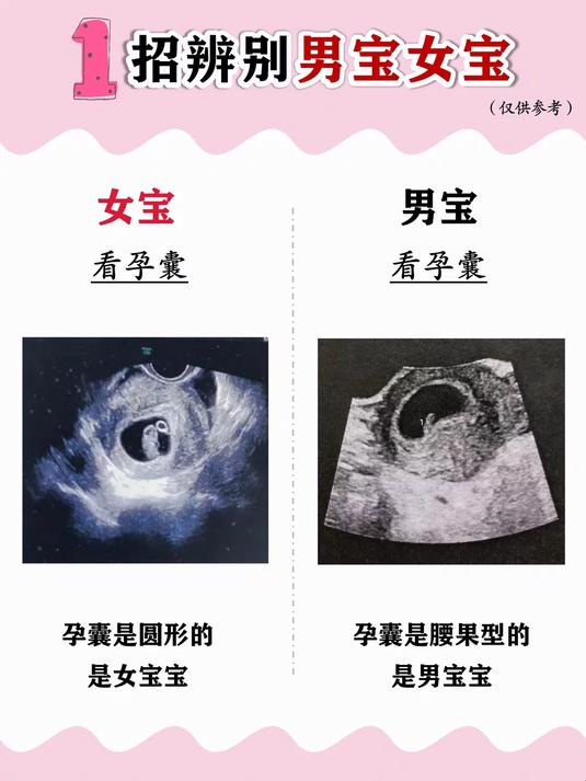 孕囊是圆形的是女宝宝 孕囊是腰果型的是男宝宝