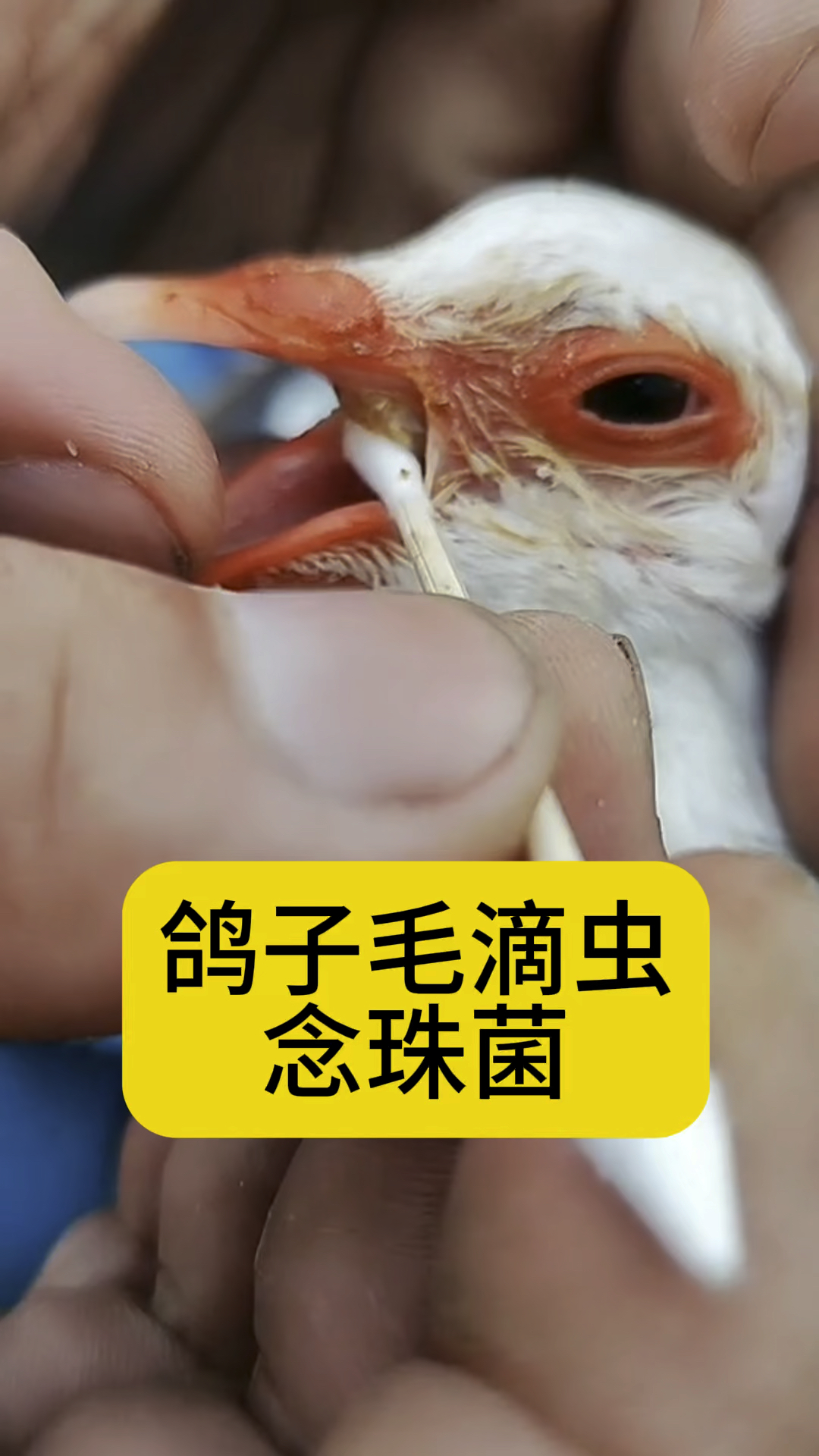 鸽子毛滴虫念珠菌,口腔有粘液怎么办?