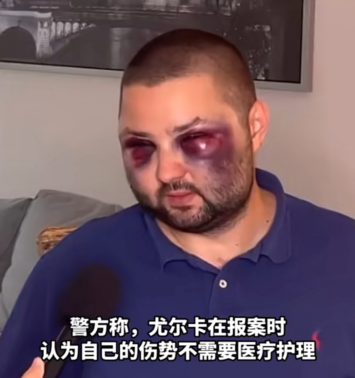 第一次看到有人被打成这样,原来熊猫眼是真的.