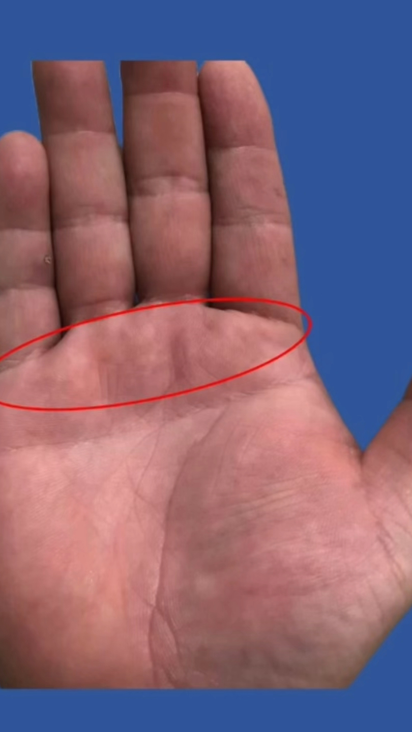 手中有三条"太阳线",人生中有三个贵人!