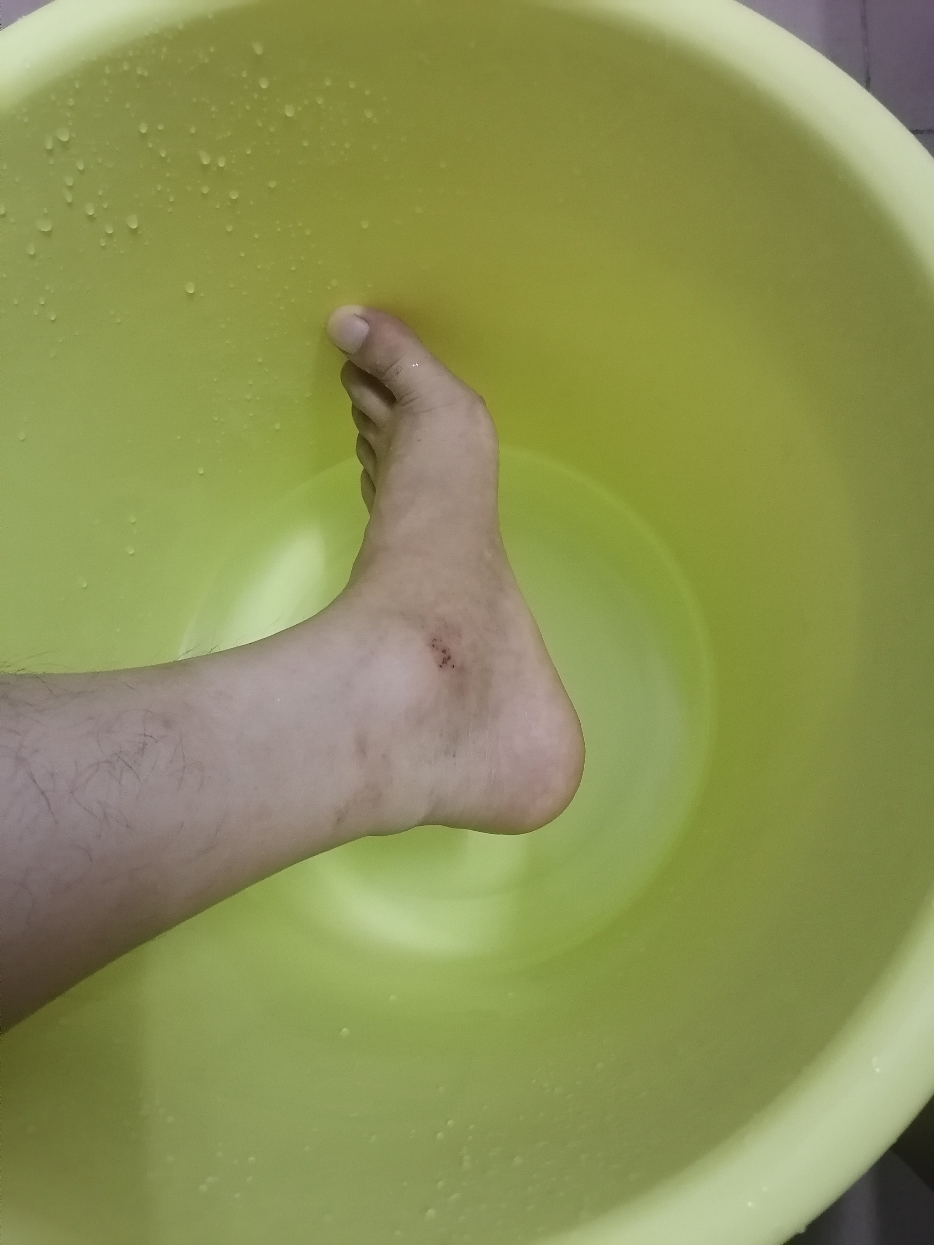 热水泡泡脚,据说可以去除扭伤的遗症,就试试不知结果咋样?