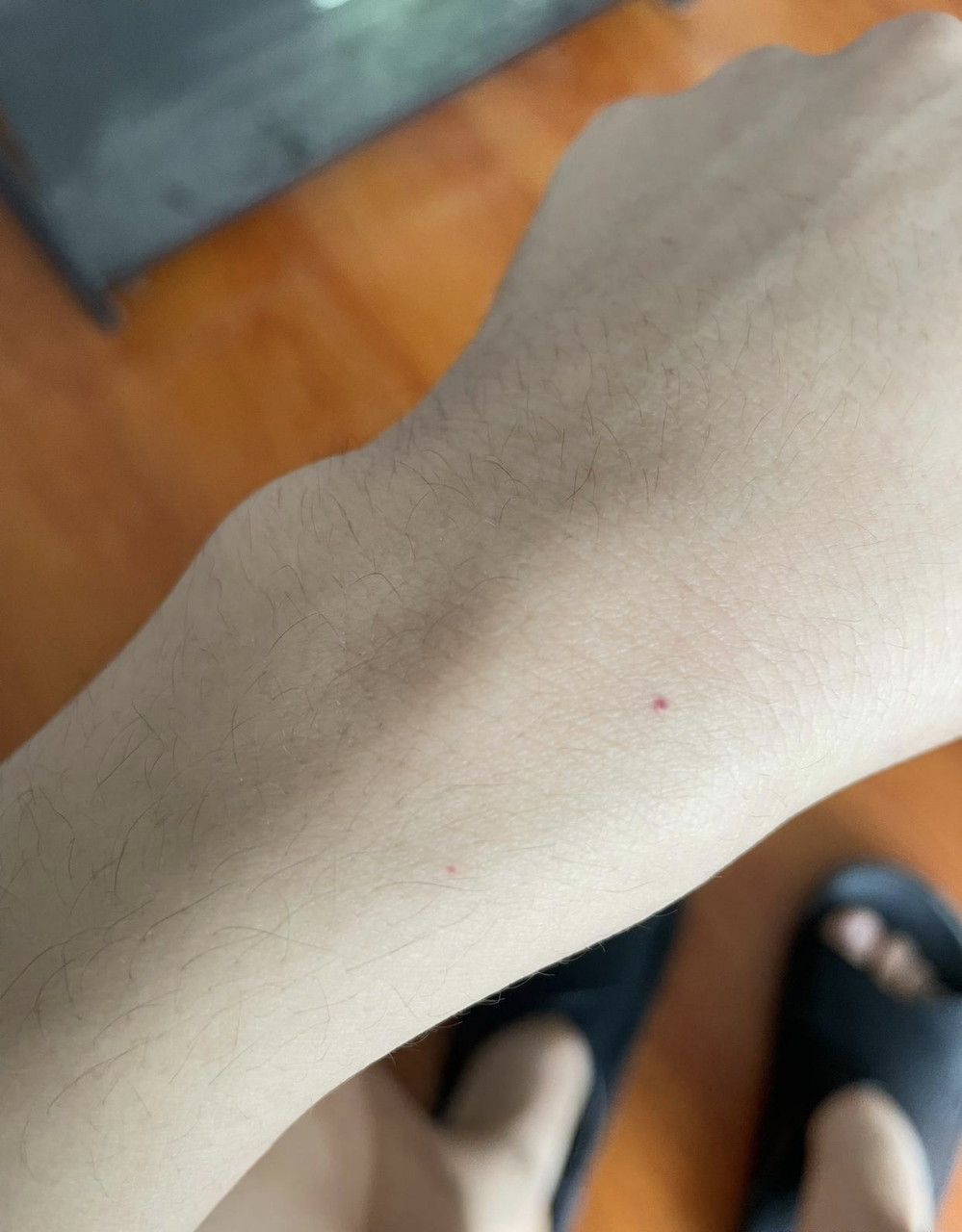 胳膊上莫名其妙多了几个小红点,我家也没蚊子啊.有人知道这是什么吗