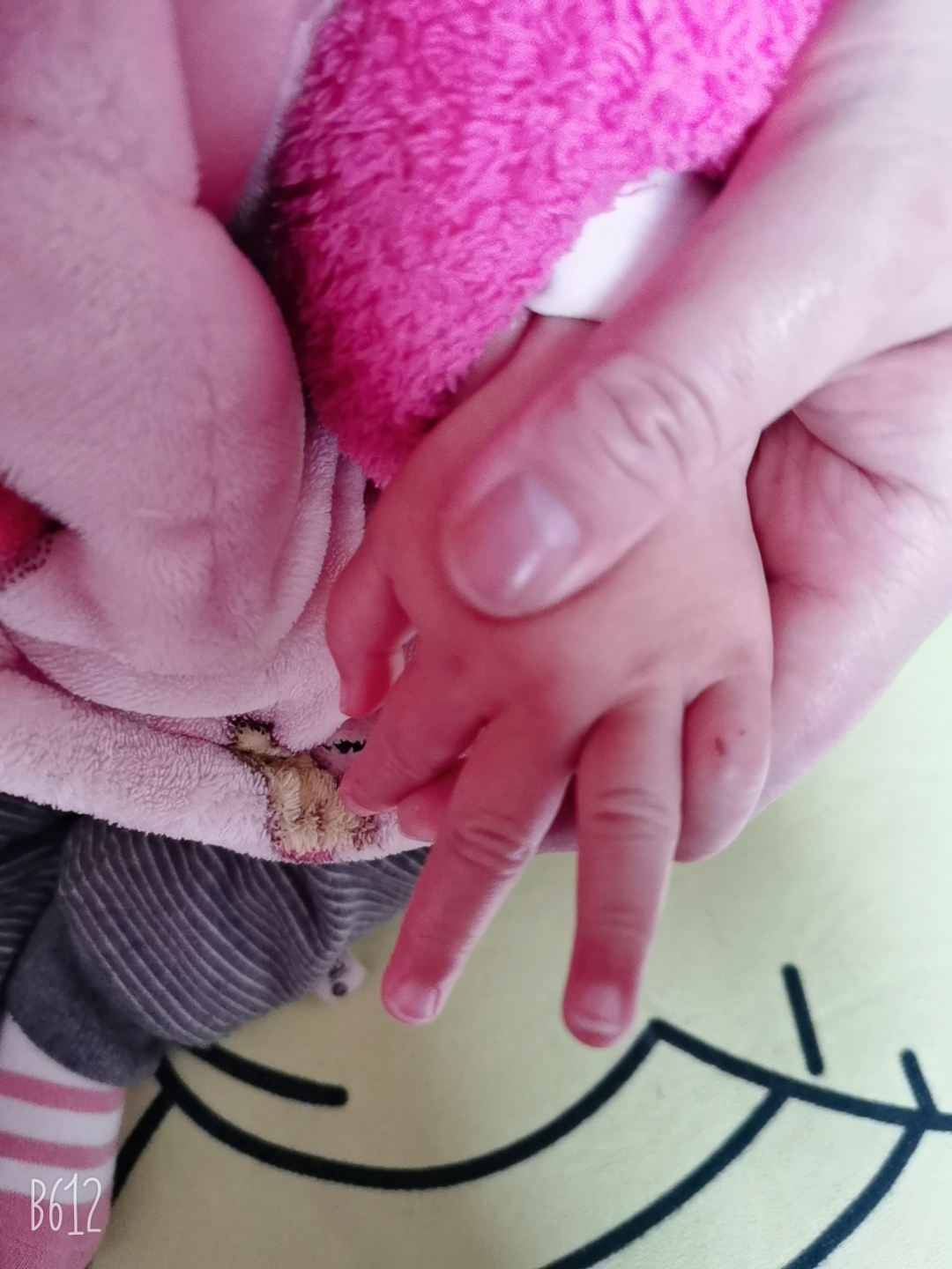 天气连续降温,害宝宝手指冻伤