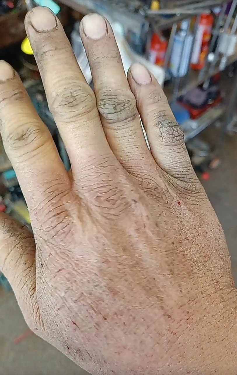 张开这只手需要多大的勇气!这是一位80后勤劳的手,挣的是最干净的钱!