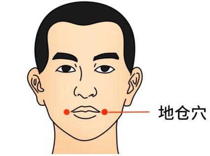 敷贴这两个穴位-面瘫很快就好