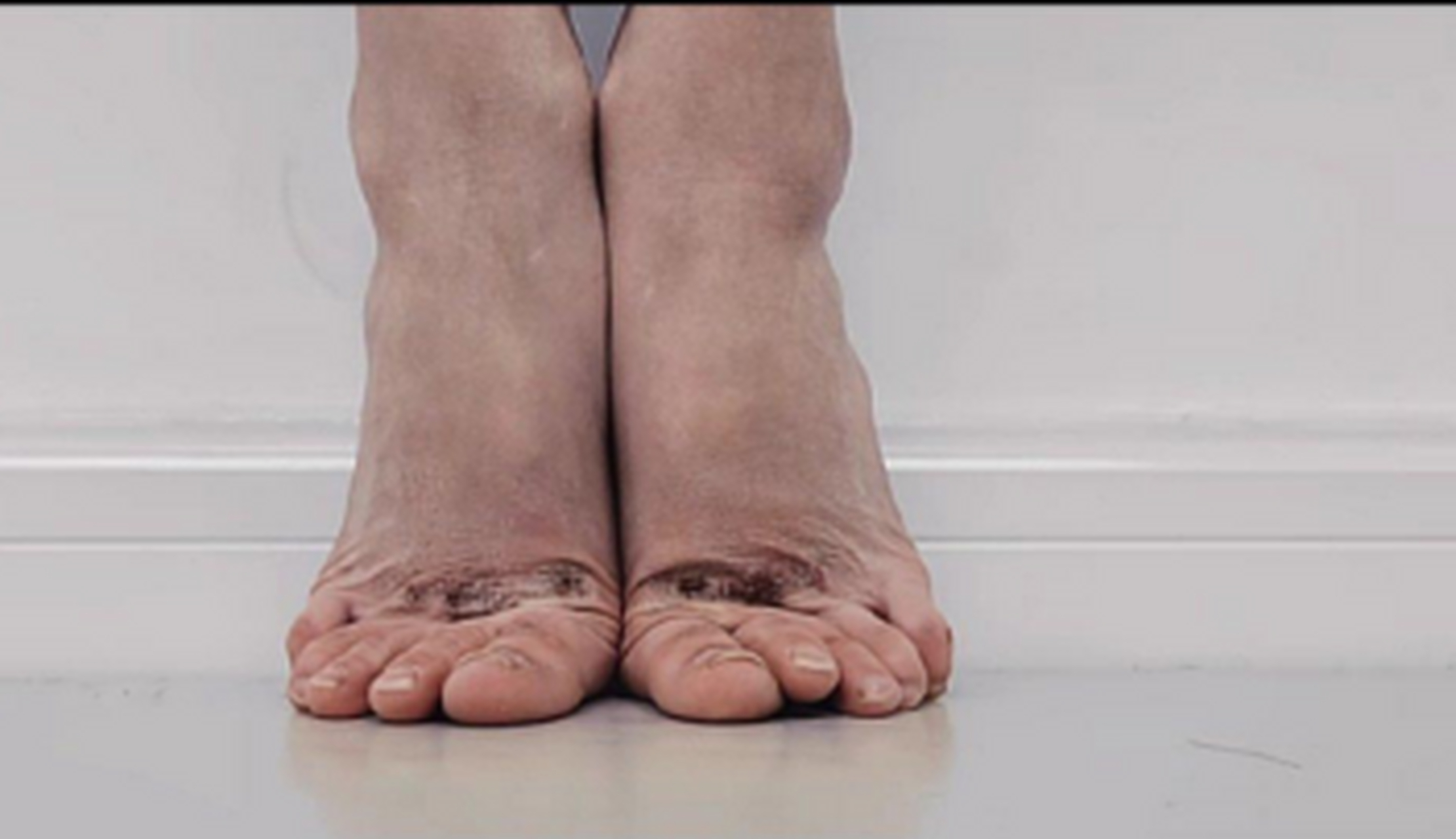 这就是芭蕾舞者的脚,每一个舞者都值得敬重#舞蹈