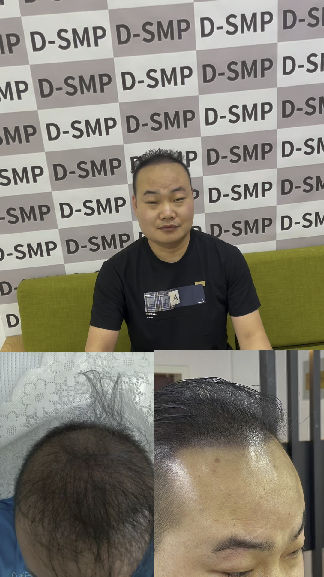 3d纹发,男士六级纹发效果加密,告别秃秃烦恼