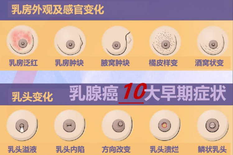 乳腺癌的照片图片图片