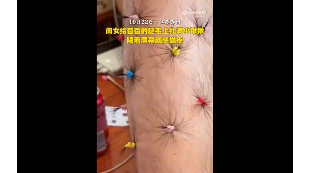 近日,江苏苏州一名小女孩在爸爸的腿毛上扎满小辫子.