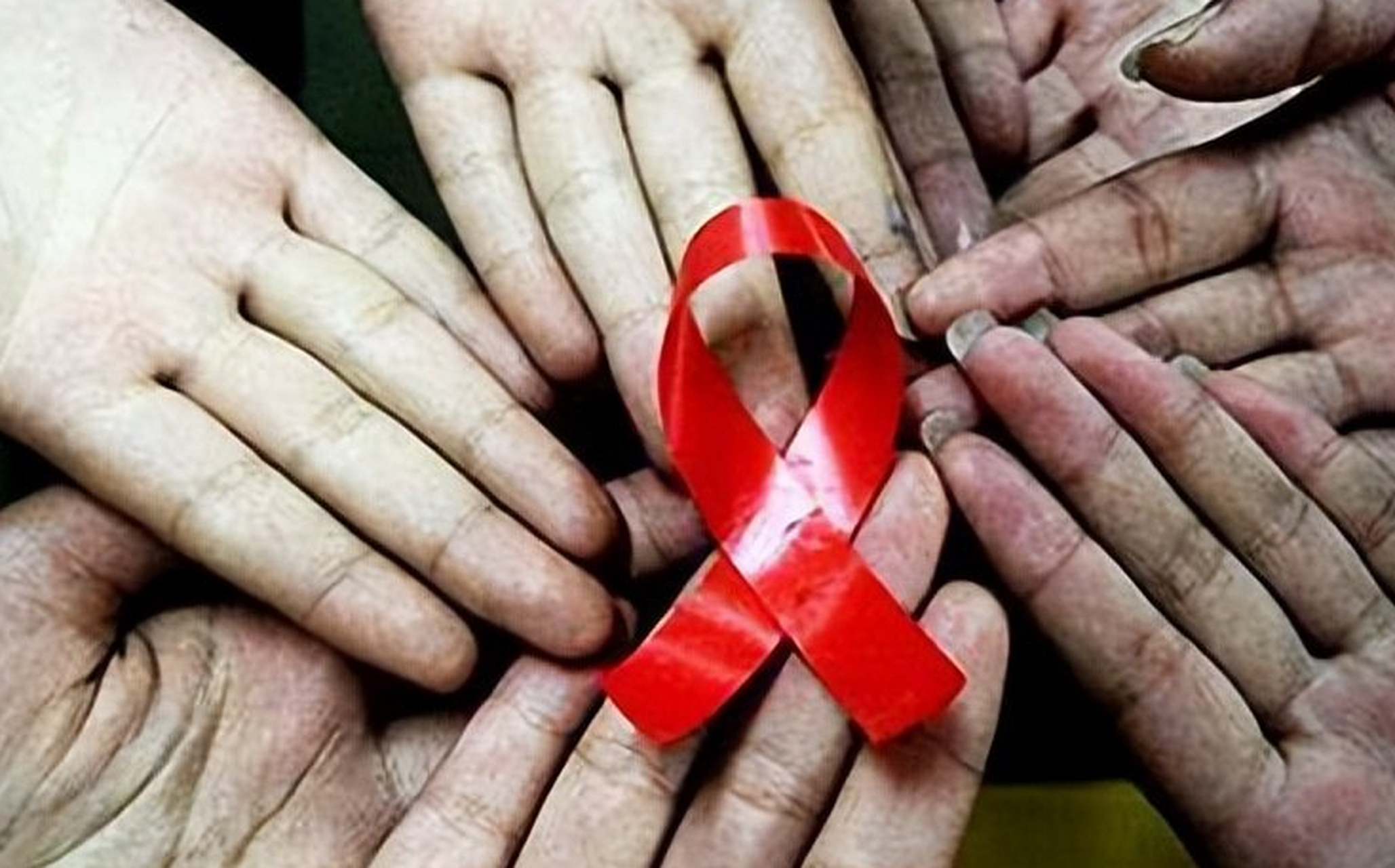 "奇迹般的治疗,艾滋病的第六例治愈已出现吗?