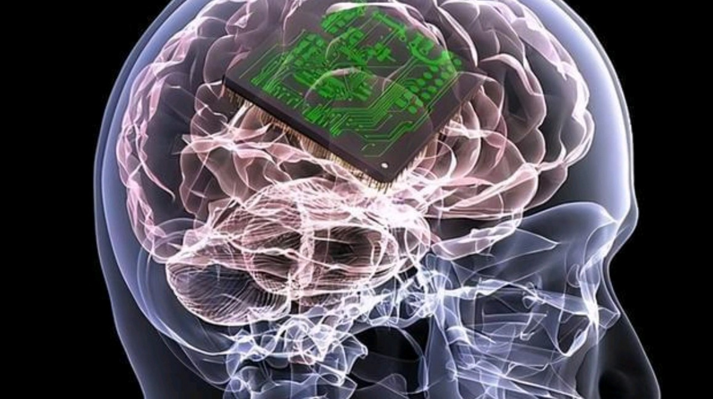 脑中植入芯片治疗抑郁是一种未来可能的治疗方法,目前仍处于研究和